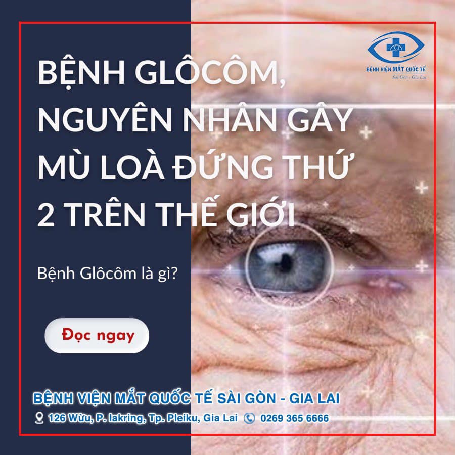 Điều trị tăng nhãn áp glocom