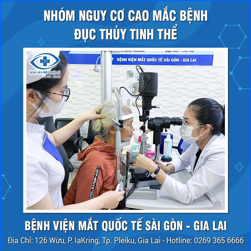 nhóm người có nguy cơ cao mắc bệnh đục thủy tinh thể