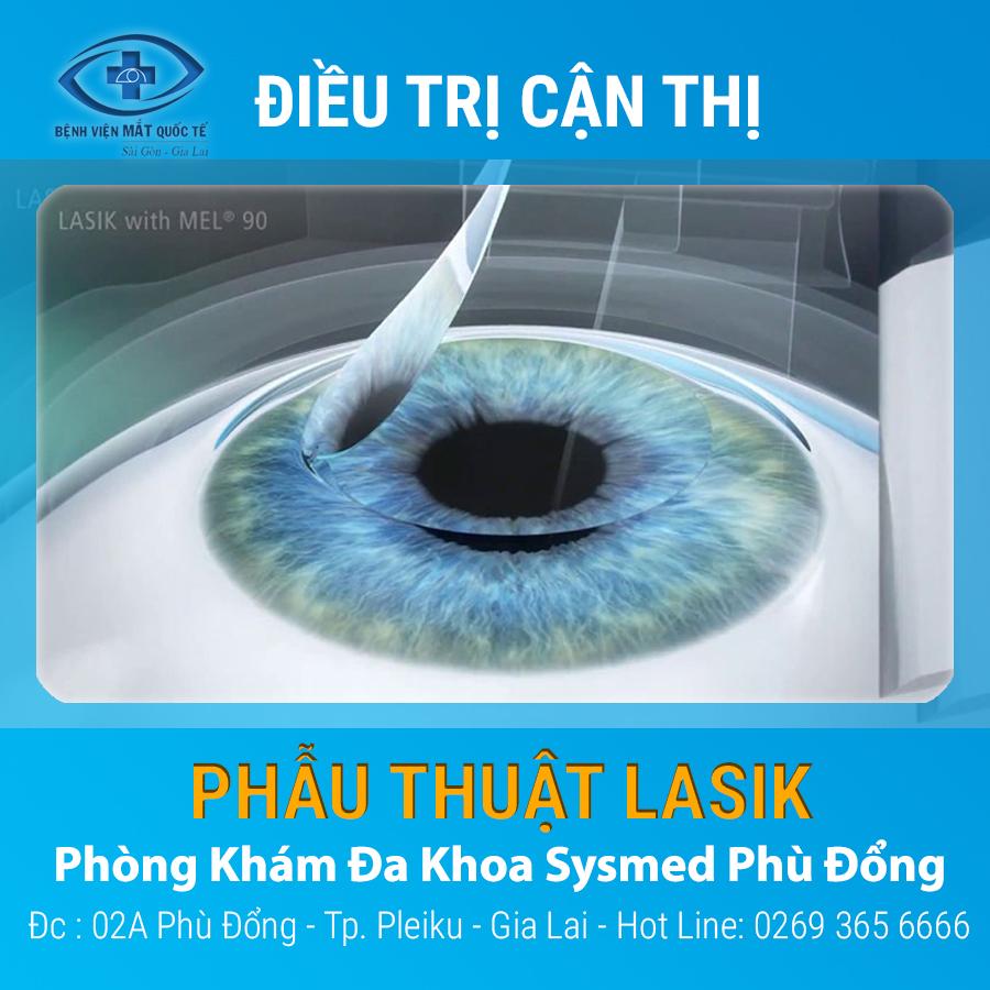 ảnh bài viết 1