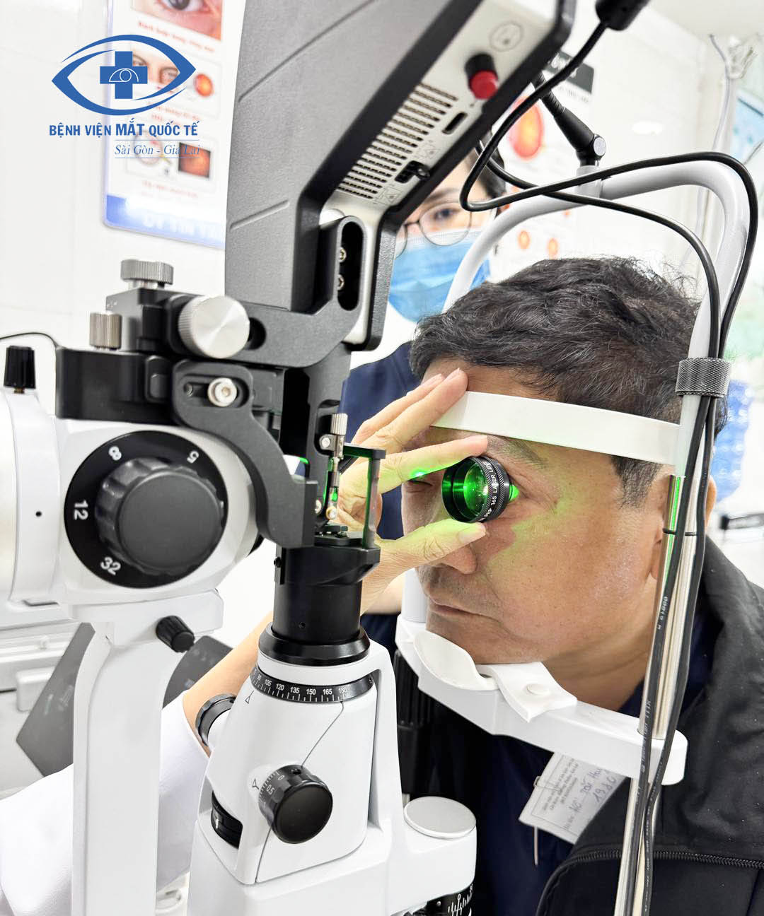 laser quang dong dieu tri day ma