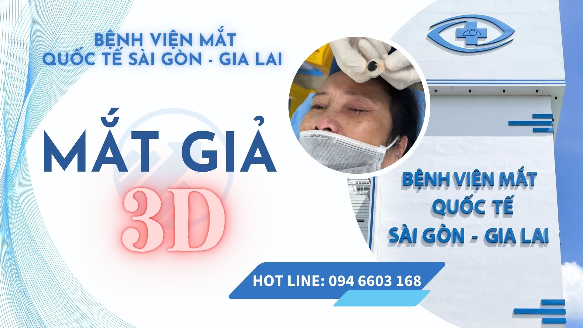 Mắt Giả Yêu Thương