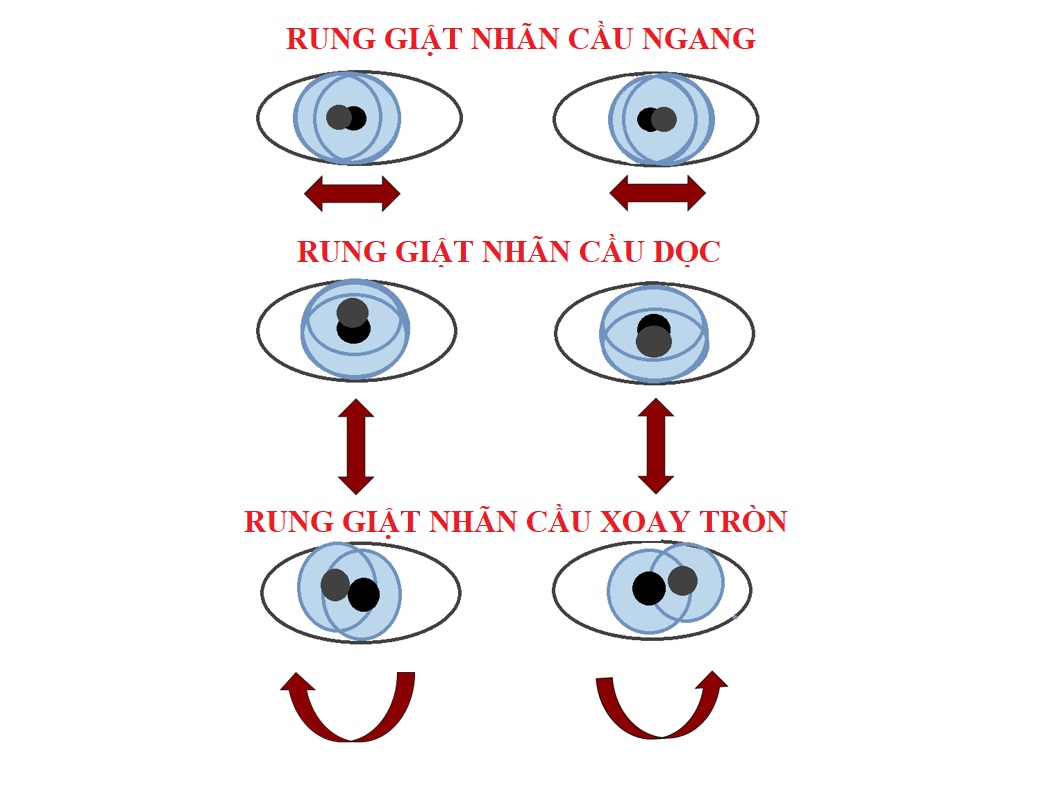 RUNG-GIAT-NHAN-CAU