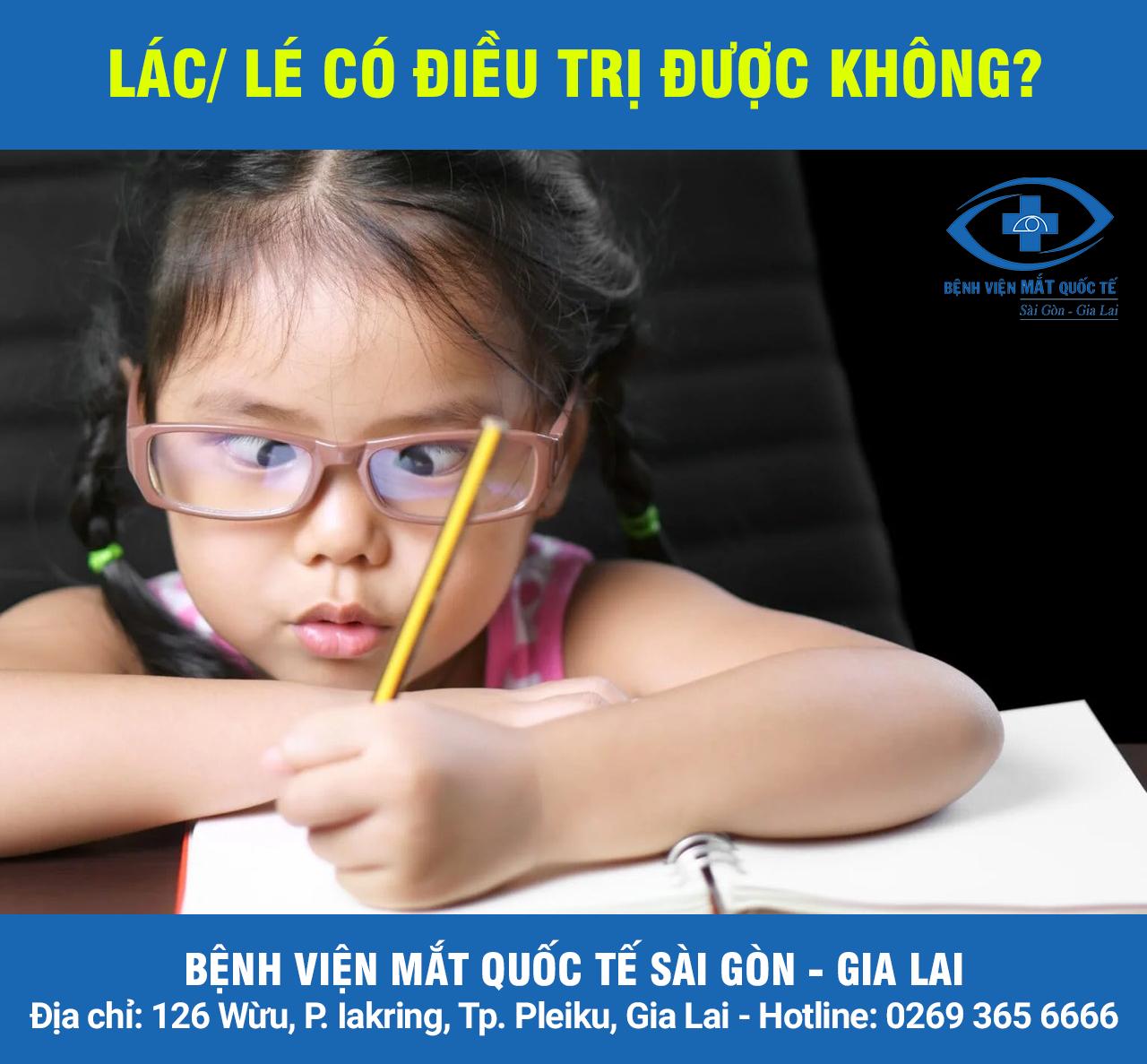 Lác lé có điều trị được không? Phương Pháp Điều Trị lác lé