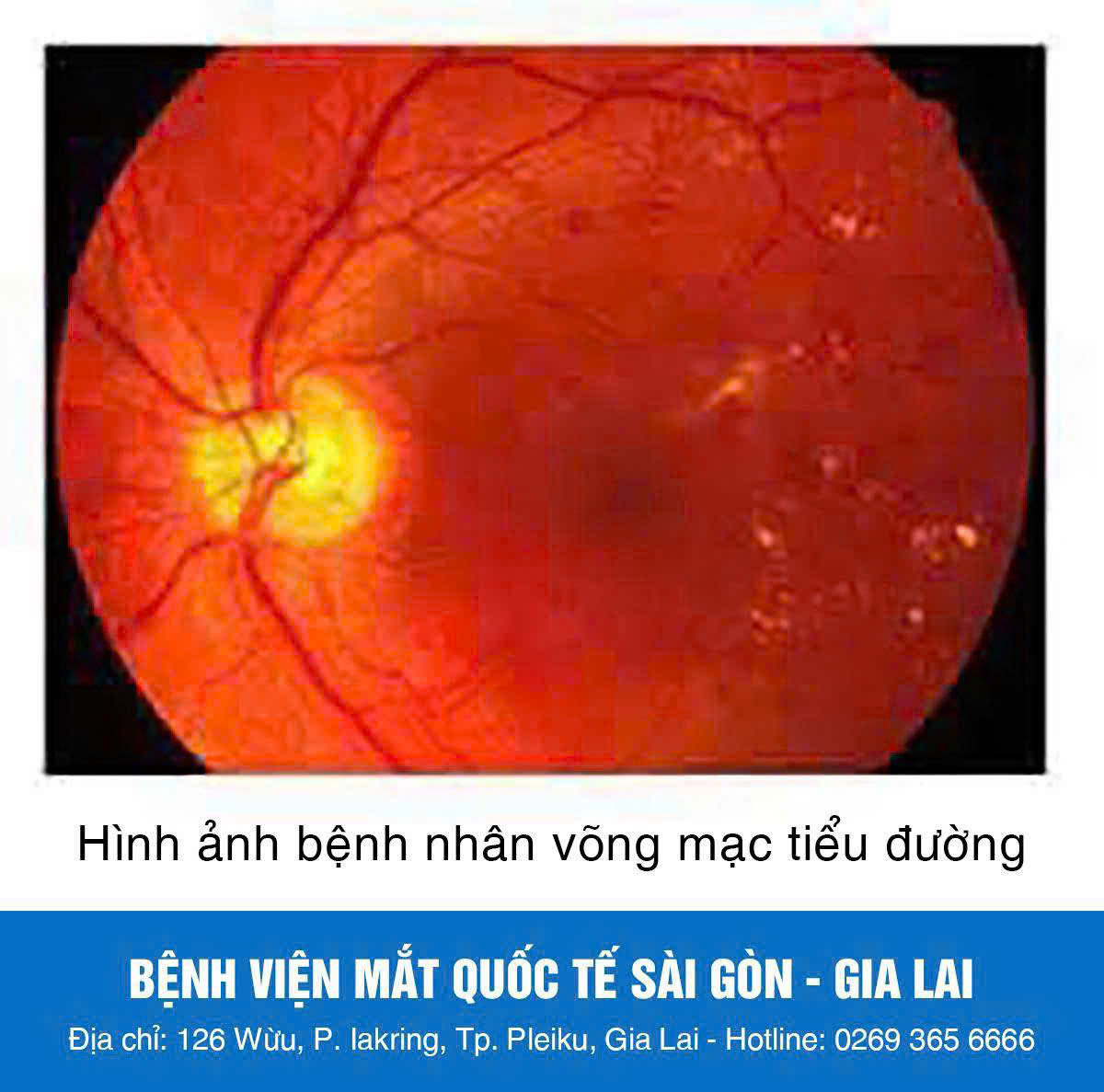 z6746551986536_0ae11fb51b129dfd1d26ae340af0fc97