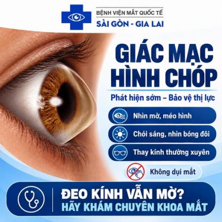 Giác Mạc Hình Chóp – Đừng Chủ Quan Khi Đeo Kính Vẫn Nhìn Mờ! | Mắt Quốc Tế Sài Gòn – Gia Lai