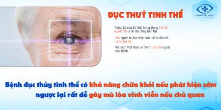 Tìm Hiểu Về: Đục Thuỷ Tinh Thể Cùng Bệnh Viện Mắt Quốc Tế Sài - Gòn Gia Lai