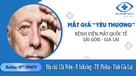 Bệnh viện Mắt Quốc tế Sài Gòn-Gia Lai: Triển khai dự án cộng đồng “Mắt giả yêu thương”