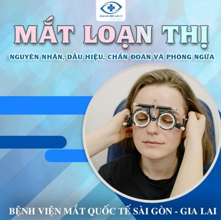 MẮT LOẠN THỊ: NGUYÊN NHÂN, DẤU HIỆU, CHẨN ĐOÁN VÀ PHÒNG NGỪA