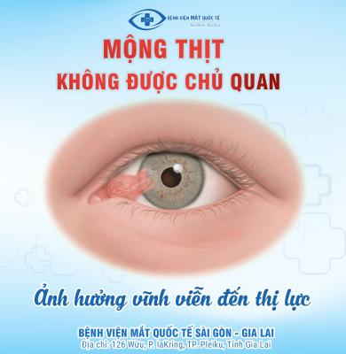 Mộng thịt là gì? Khi nào cần phẫu thuật mộng thịt?