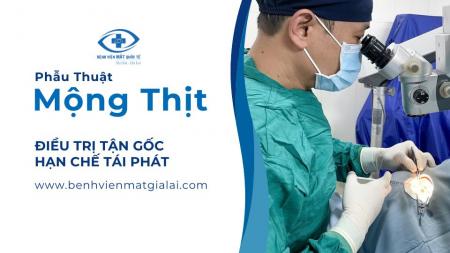 Mộng thịt là gì? Khi nào cần phẫu thuật mộng thịt?