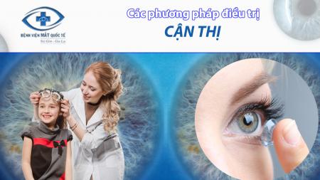 Các Phương Pháp Điều Trị Cận Thị: Lựa Chọn Nào Phù Hợp Với Bạn?