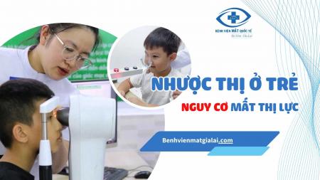 Nhược Thị Ở Trẻ Em – Nguy Cơ Mất Thị Lực Nếu Không Phát Hiện Sớm