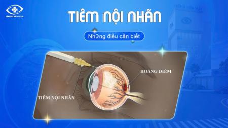 TIÊM NỘI NHÃN - NHỮNG ĐIỀU CẦN BIẾT?